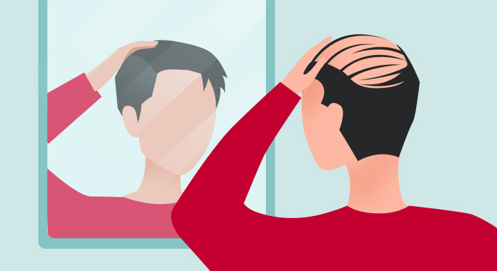 【精彩播客】挺“秃”然的，发际线的秘密就这么被揭开了 | 脱发应对手册